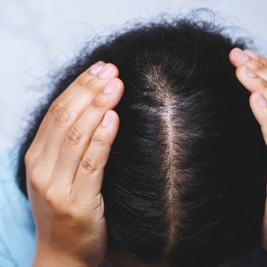 Unravelling the Strands of Hair Loss Vs Shedding