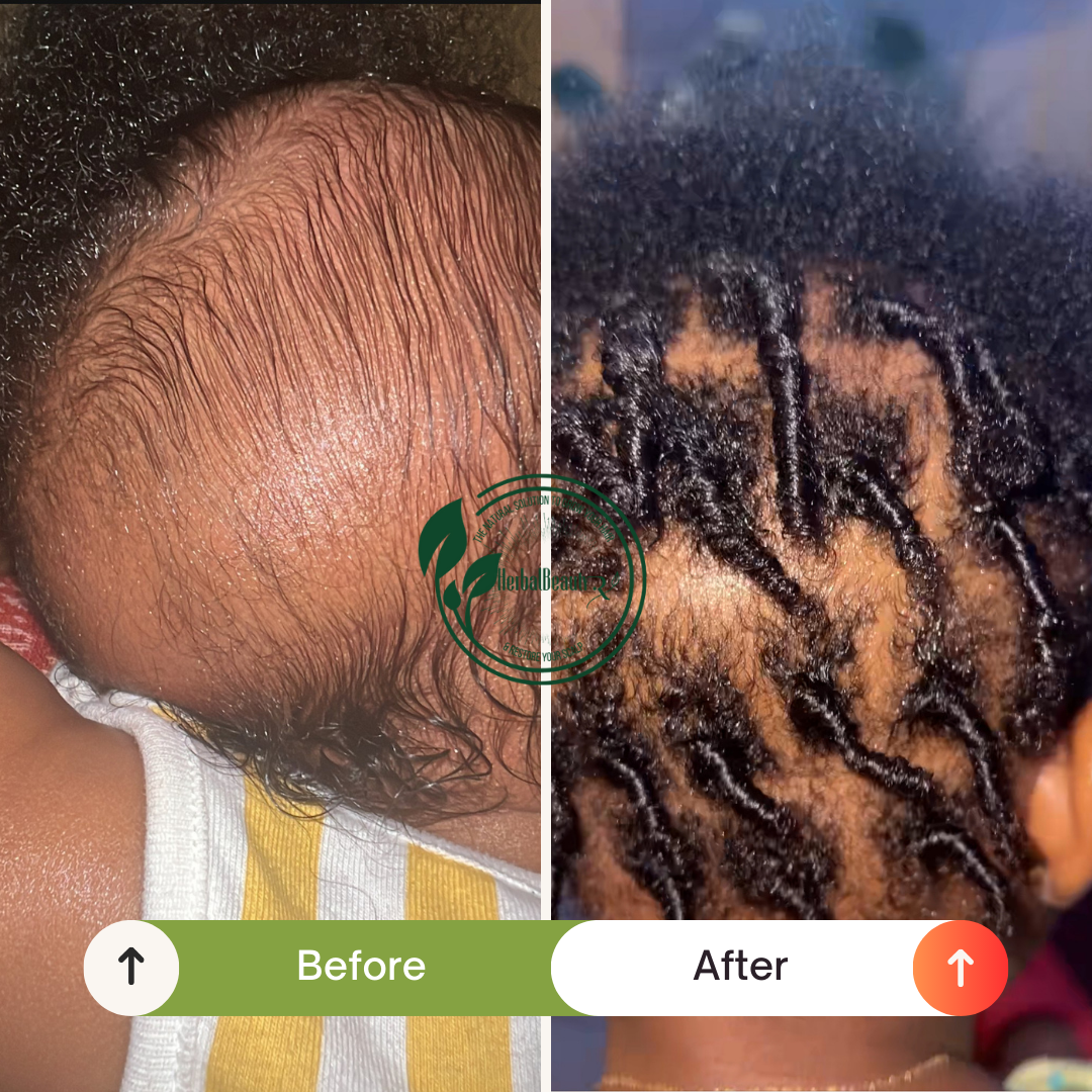 Biotin + Rosemary Hair Grease results herbalbeautyrxLLC