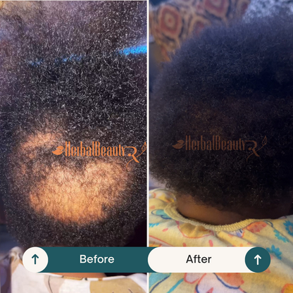 Before and after photos of a Baby/ Infant hair growth. The Before image shows the strating point, and the After image highlights the improved hair thickness and length after using our Hair  Grease and Hydrating Hair Mist.